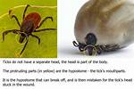 Will a Tick Fall off?