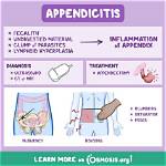 Will Appendicitis Kill You?