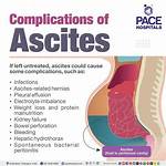 Will Ascites Come Back?