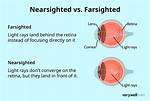 Will Be Far Sighted?