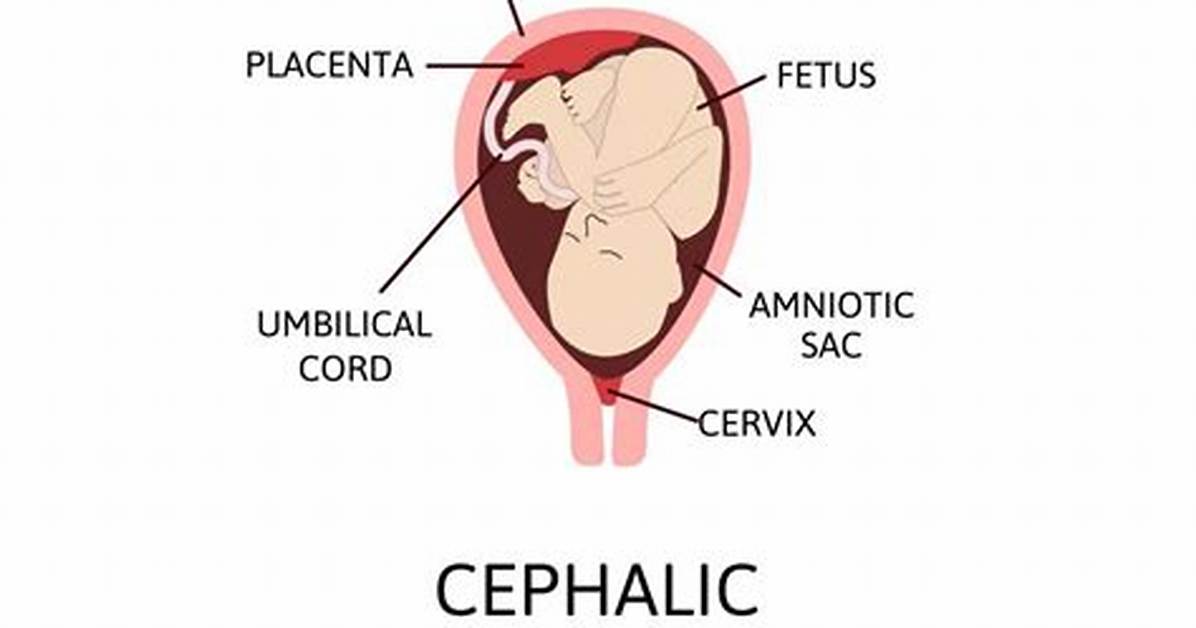 Will Cephalic Presentation Change?