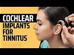 Will Cochlear Implants Cure Tinnitus?