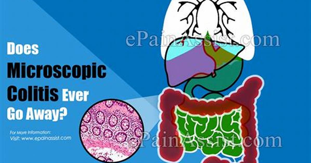 Will Colitis Go Away?