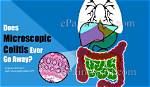 Will Colitis Go Away?