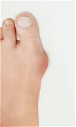 Will Dislocated Toe Heal Itself?