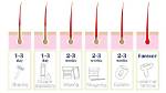Will Epilating Remove My Tan?