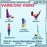 Will Exercise Help Venous Insufficiency?