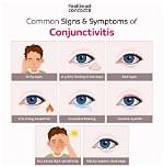 Will Eyewash Help Conjunctivitis?