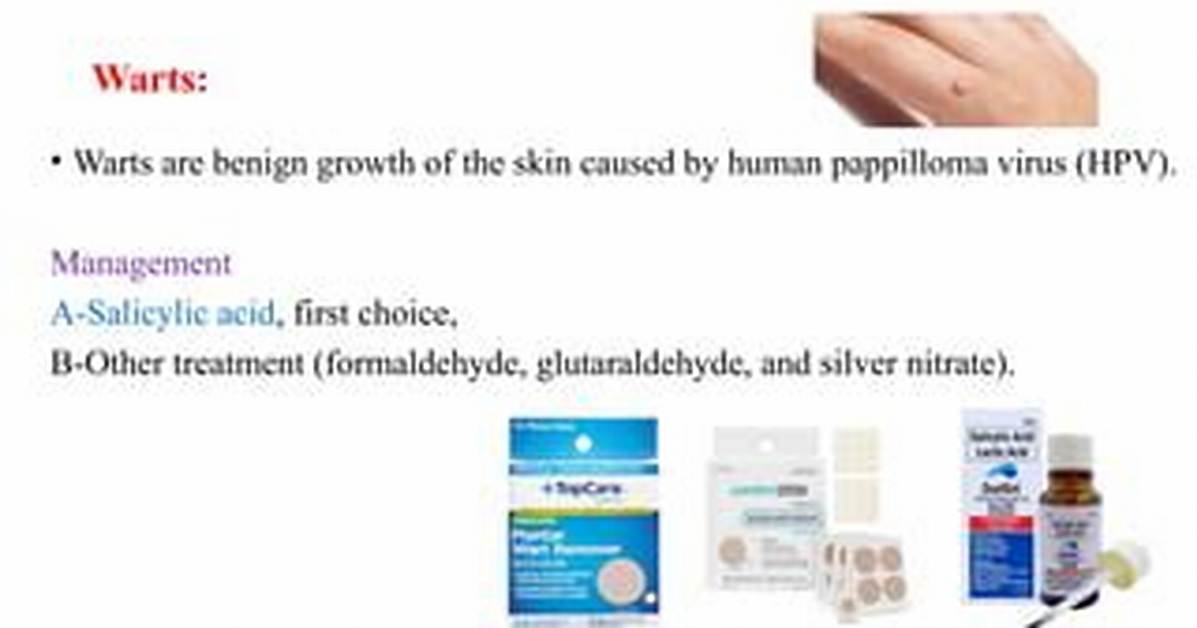 Will Formaldehyde Kill Warts?