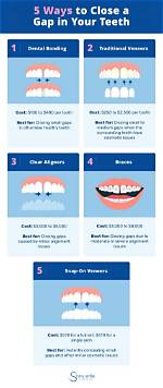Will Gaps in Teeth Close?