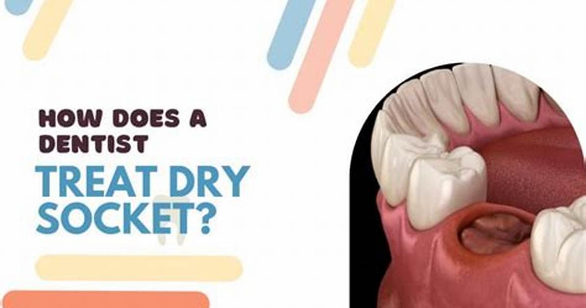 Will Gauze Cause Dry Socket?