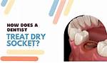 Will Gauze Cause Dry Socket?