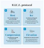 Will Ice Stop Bruising?