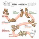 Will Impacted Stool Eventually Come out?