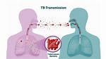 Will Latent Tb Spread?