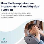 Will Methamphetamine Affect Anesthesia?