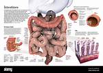 Will My Intestine Explode?