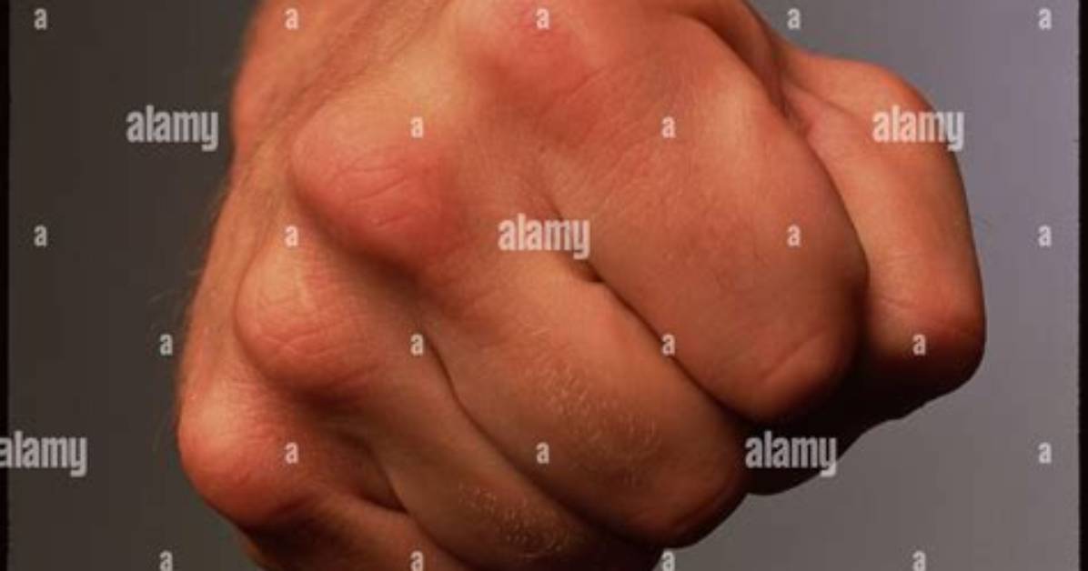 Will Not Knuckle Under?