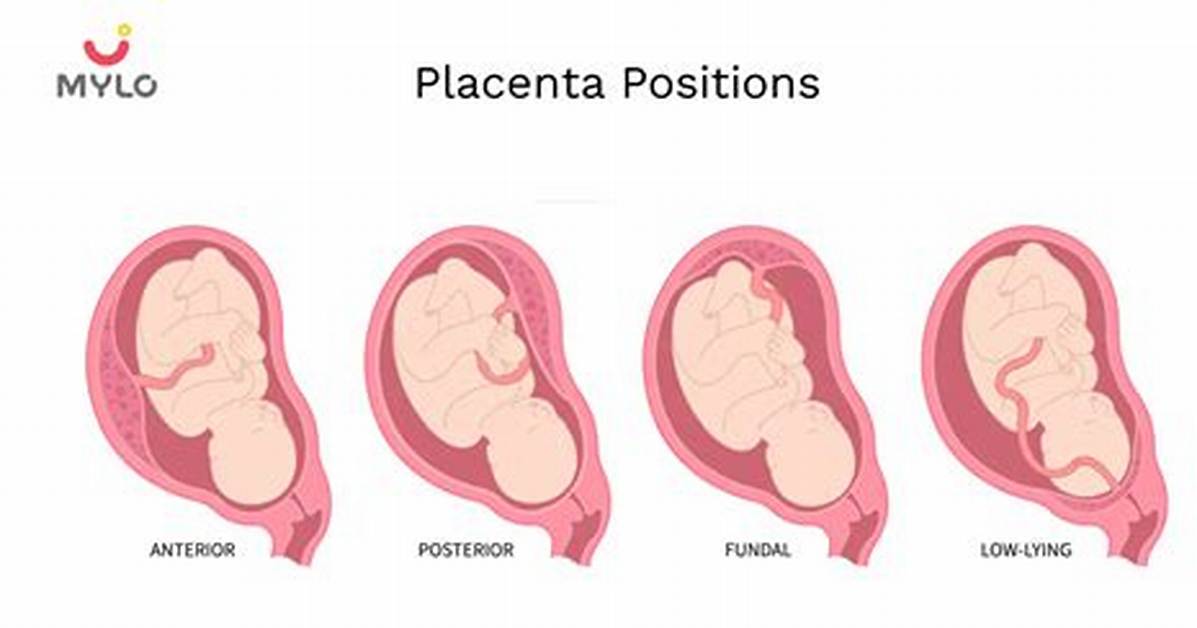 Will Placenta Position Change?