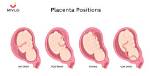 Will Placenta Position Change?