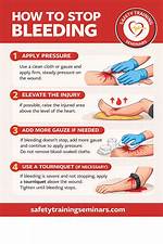 Will Ponstan Stop Bleeding?