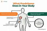 Will Prednisone Help Thyroiditis?
