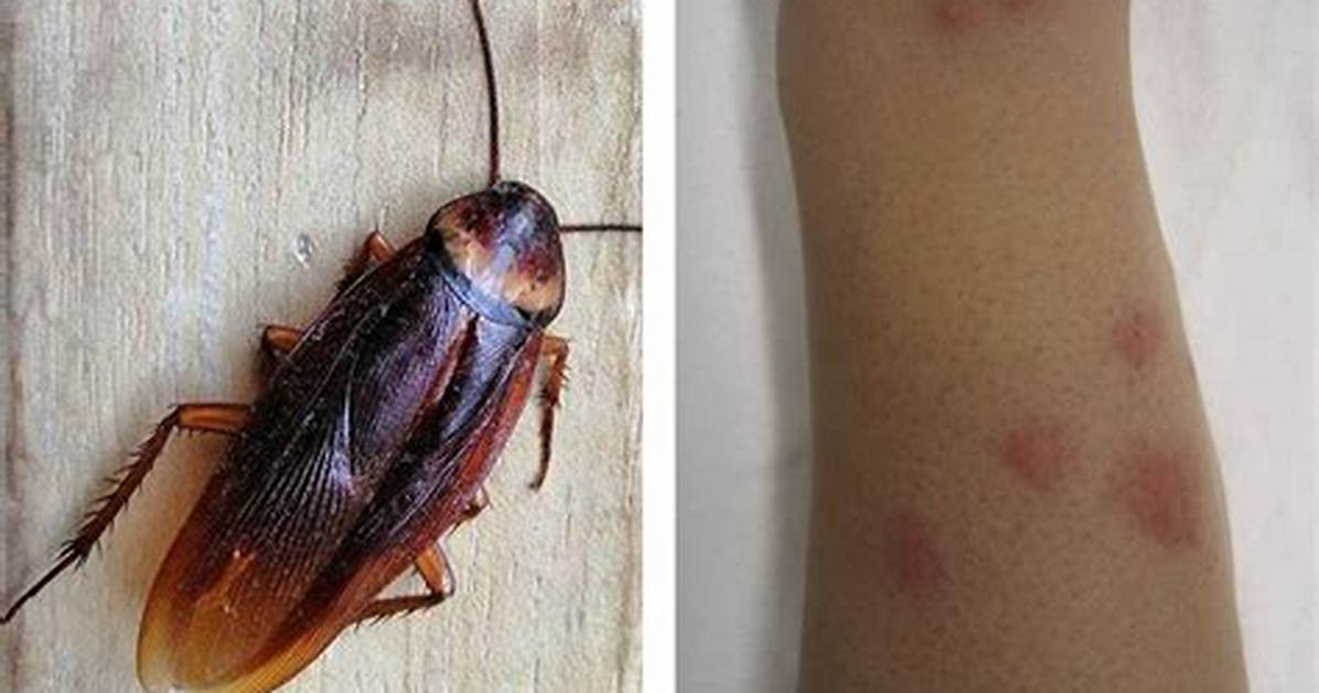 Will Roaches Bite You?