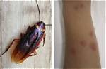 Will Roaches Bite You?