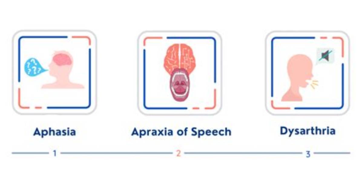 Will Speech Return After Stroke?