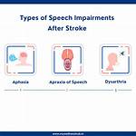 Will Speech Return After Stroke?