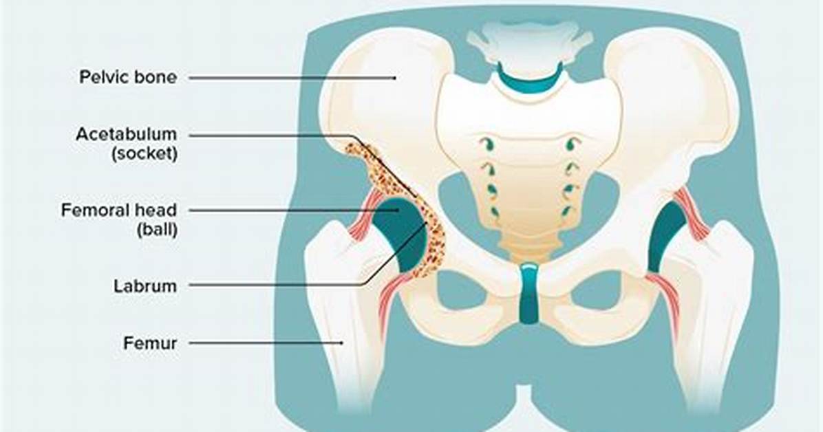 Will Surgery Help Impingement?