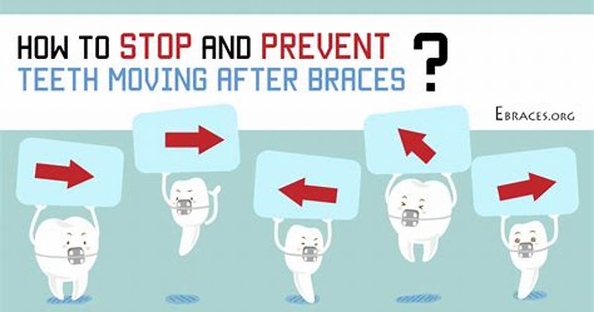 Will Teeth Ever Stop Moving?