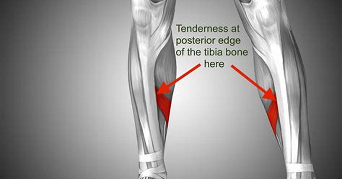 Will Tibia Go Away?