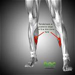 Will Tibia Go Away?