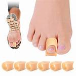 Will Toe Straighteners Work?