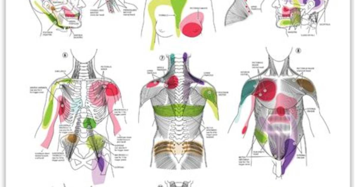Will Trigger Points Go Away?