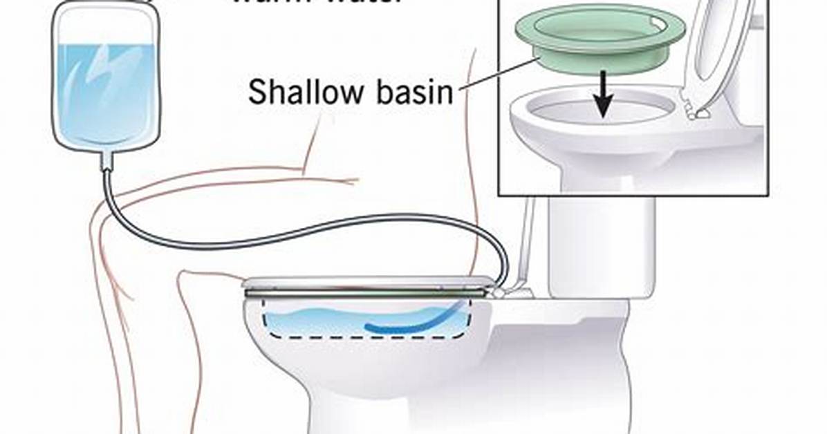 Would a Sitz Bath?