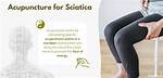 Would Acupuncture Help Sciatica?