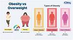 Would Be Considered Overweight?