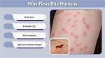 Would Fleas Bite Humans?