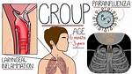 Would Ventolin Help Croup?