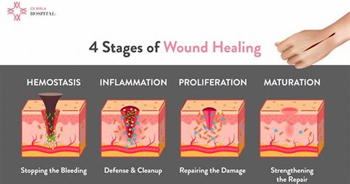 Wound Down
