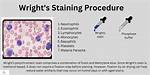 Wrights Stain