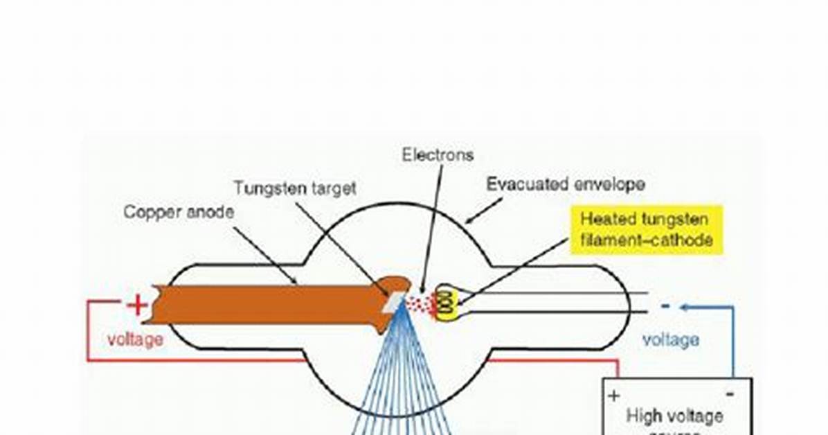 X-Ray Overview