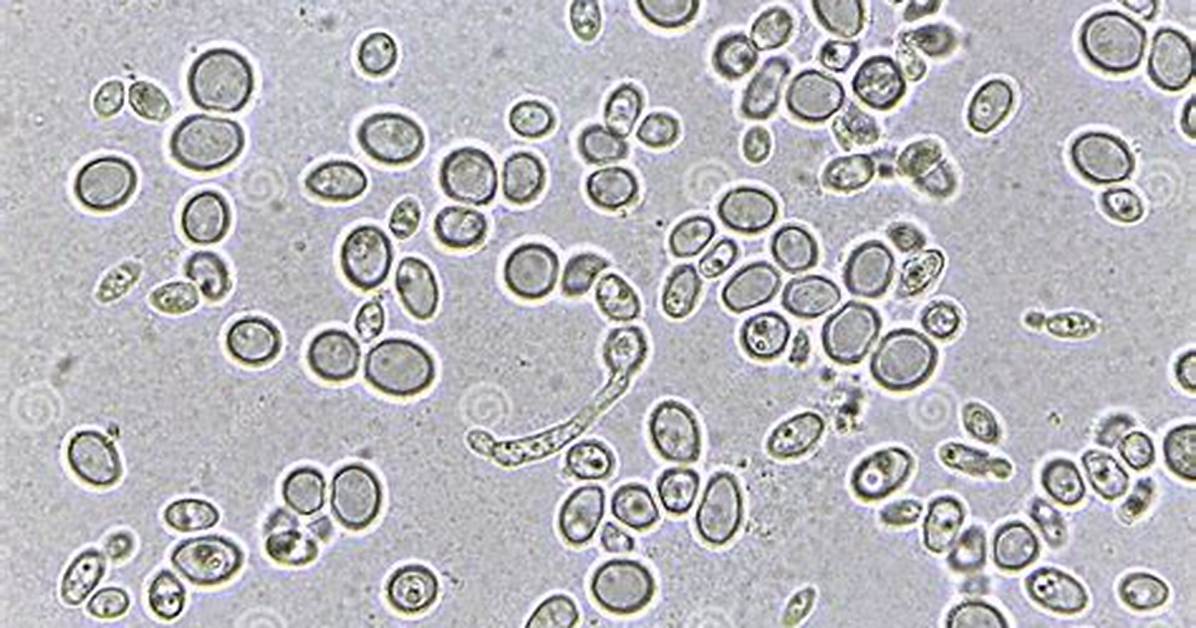 Yeast Under Microscope