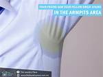 Yellow Armpits