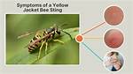 Yellow Jacket for Example
