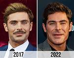 Zac Efron’s Magical Face Change, the Curious Case of the Chiseled Jaw